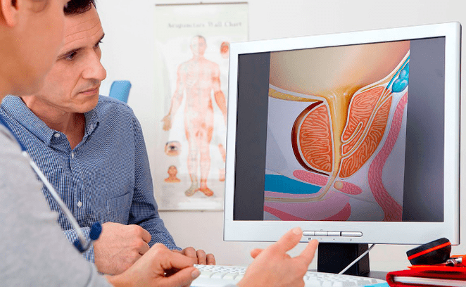 Diagnose von Prostatitis