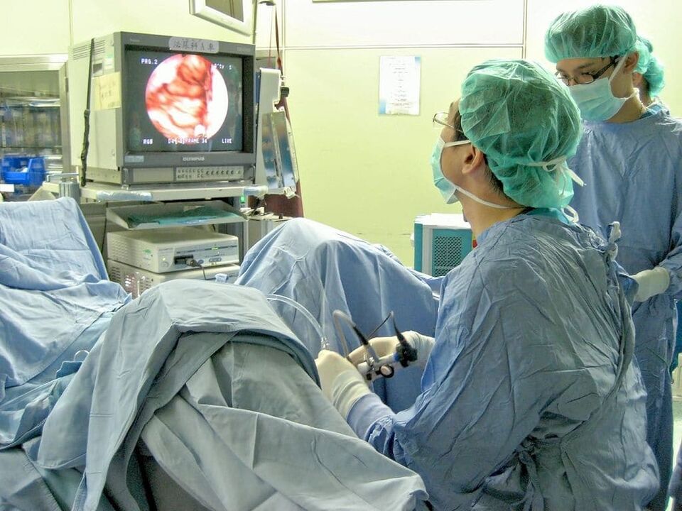chirurgische Behandlung der kalkulösen Prostatitis